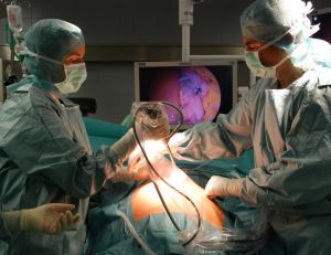 La fibroscopie bronchique