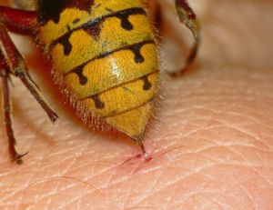 Piqûre de frelon